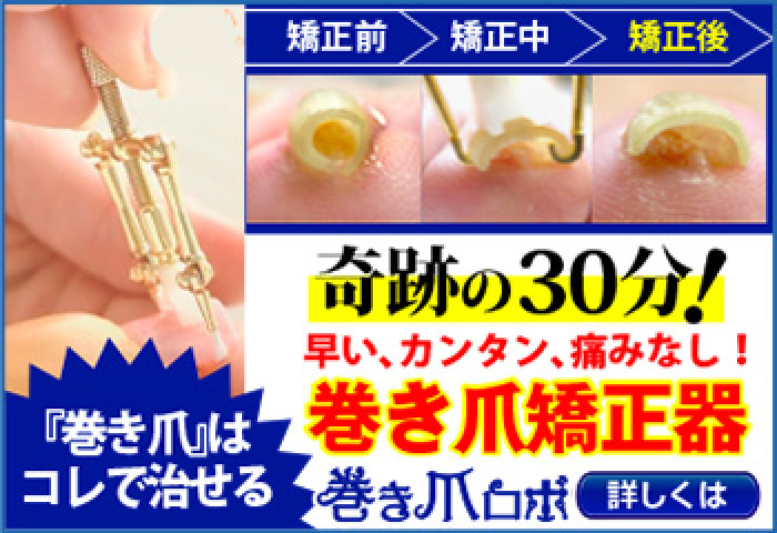 巻き爪の痛みから解放された！ 【巻き爪ロボ】徹底レビュー
